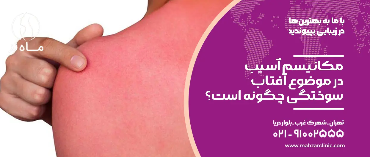 آفتاب سوختگی پوست