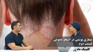 بیماری در استخر عمومی
