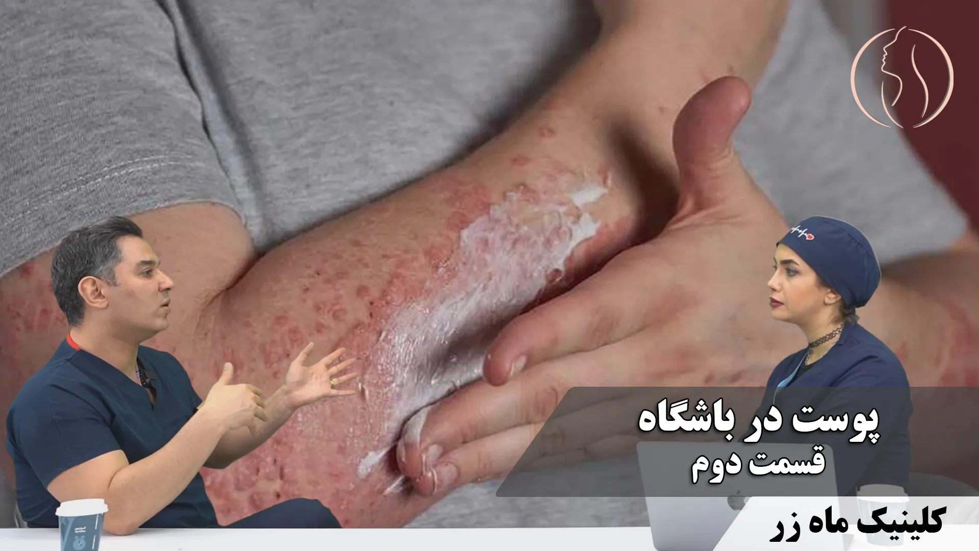 بیماری پوستی در باشگاه