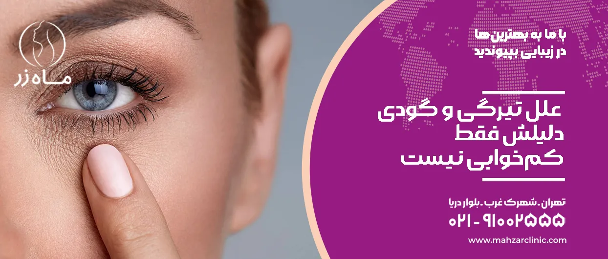 تشخیص تیرگی و گودی زیر چشم