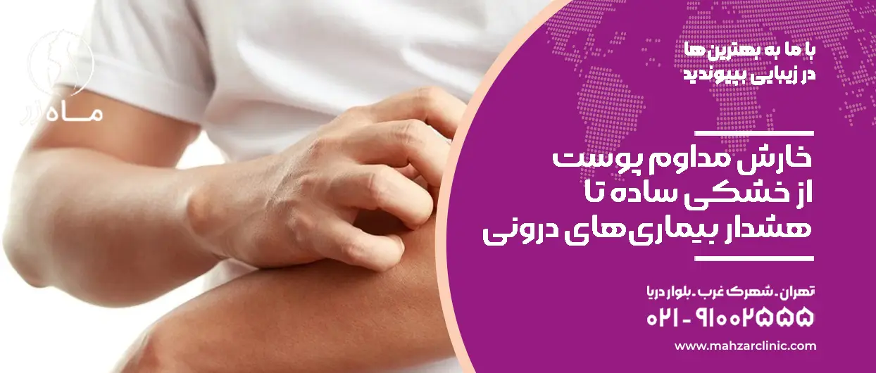 خارش مداوم پوست؛ از خشکی ساده تا هشدار بیماری‌های درونی