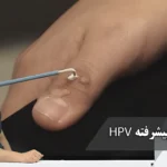 درمان‌های پیشرفته HPV