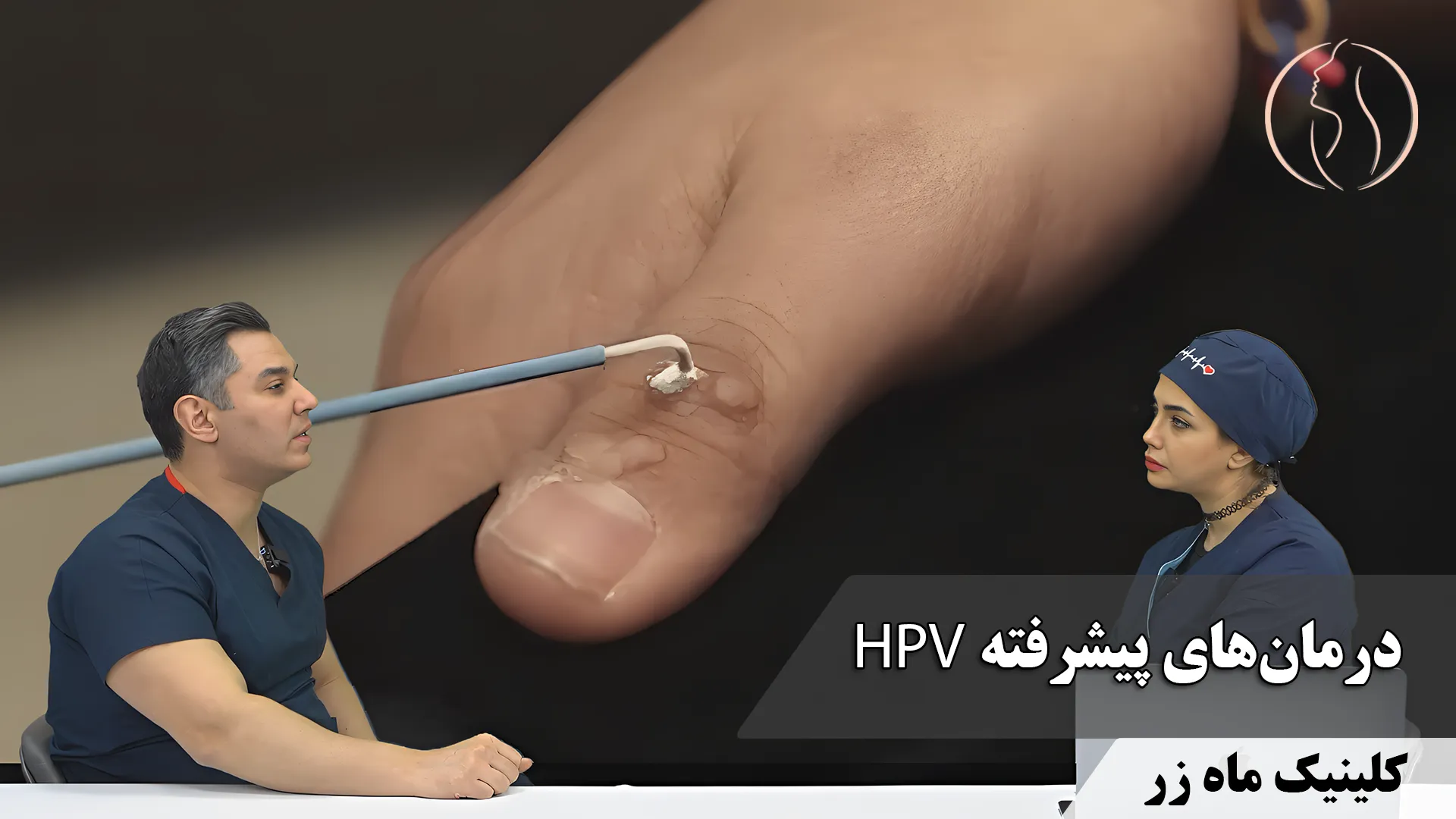 درمان‌های پیشرفته HPV