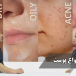 شناخت انواع پوست و روتین مراقبتی