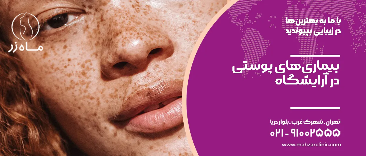 پوست در آرایشگاه