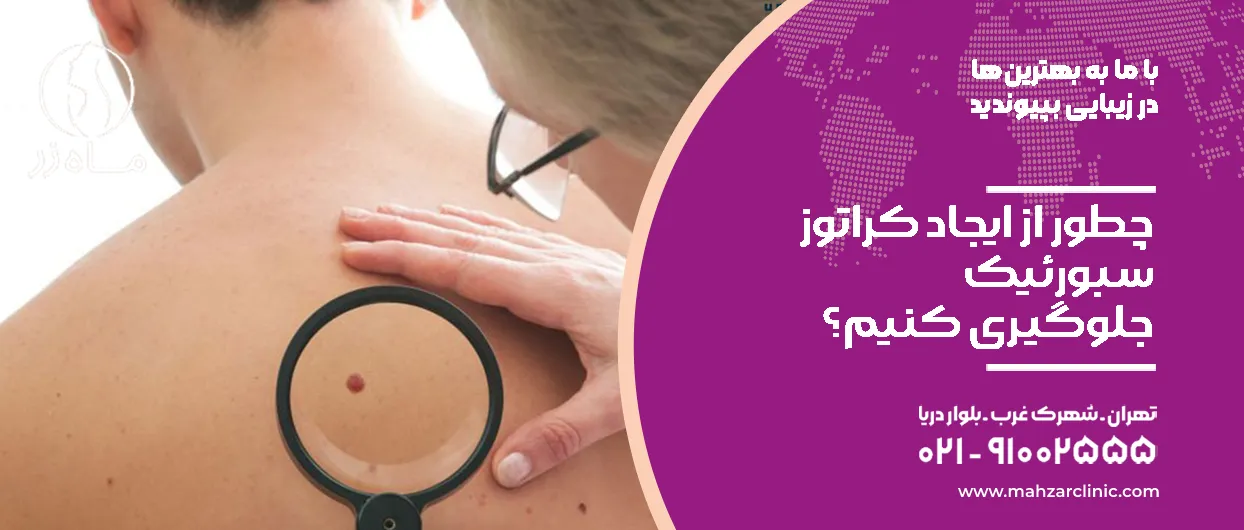 چطور از ایجاد کراتوز سبورئیک جلوگیری کنیم؟